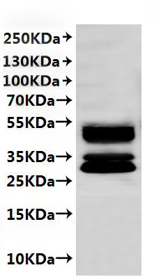 Recombinant Mouse C5a anaphylatoxin chemotactic receptor 1 (C5ar1)-VLPs (CSB-MP003996MO)