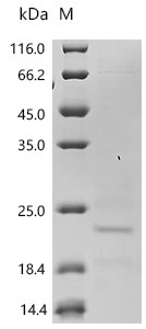 Recombinant Mouse Inactive tyrosine-protein kinase transmembrane receptor ROR1 (Ror1), partial (Active) (CSB-MP4008MO)