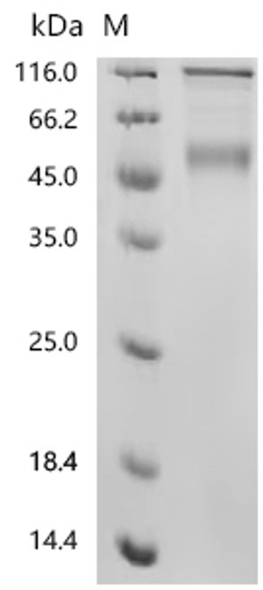 Recombinant Mouse Killer cell lectin-like receptor subfamily G member 1 (Klrg1), partial, Biotinylated (CSB-MP012472MO-B)