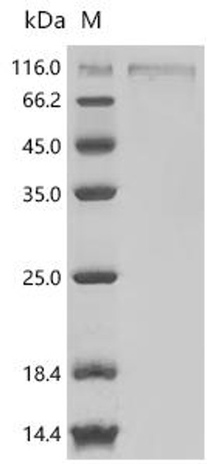 Recombinant Macaca fascicularis Heat shock protein HSP 90-beta (HSP90AB1) (CSB-MP686992MOV)