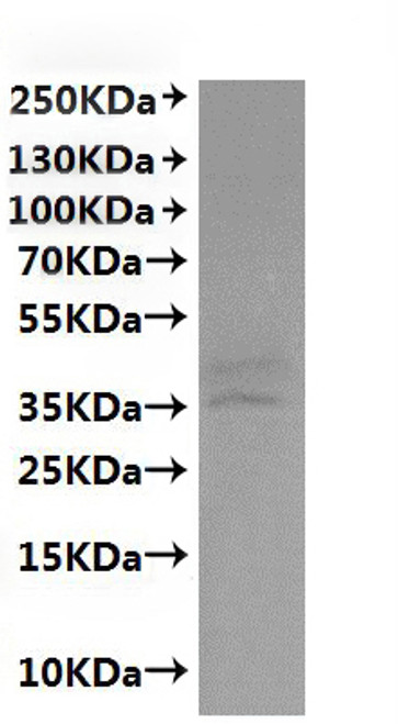 Recombinant Macaca fascicularis C5a anaphylatoxin chemotactic receptor 1 (C5AR1)-VLPs (CSB-MP003996MOW)