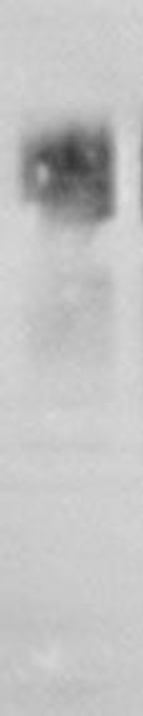 Recombinant Human Endothelin-1 receptor (EDNRA)-VLPs (Active) (CSB-MP007403HU)