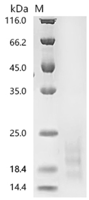 Recombinant Human Myosin regulatory light chain 12A (MYL12A) (CSB-BP015307HU)