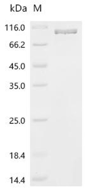 Recombinant Mouse Heat shock protein HSP 90-beta (Hsp90ab1) (CSB-BP010808MO)