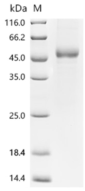 Recombinant Human Thrombopoietin (THPO) (CSB-BP023509HU(A4))