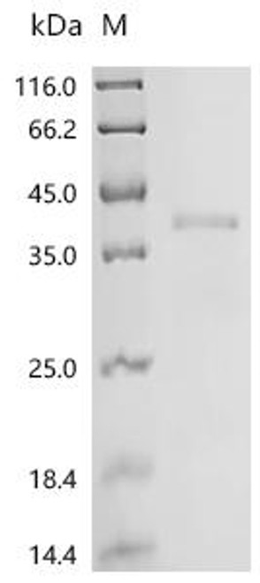 Recombinant Human Transcription factor PU.1 (SPI1) (CSB-BP022567HU)