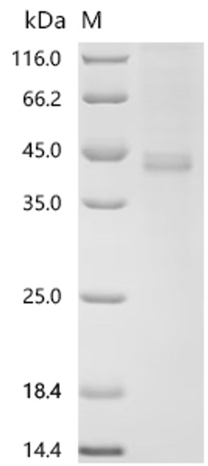 Recombinant Human Protein Wnt-5a (WNT5A) (CSB-BP026138HUm8)
