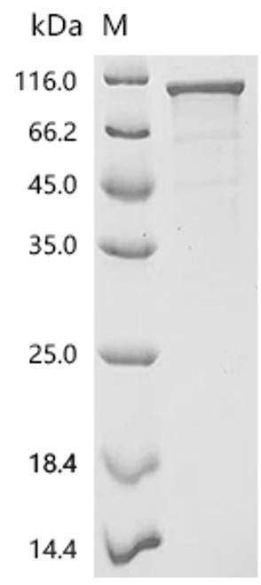 Recombinant Macaca fascicularis Heat shock protein HSP 90-beta (HSP90AB1) (CSB-BP686992MOV)