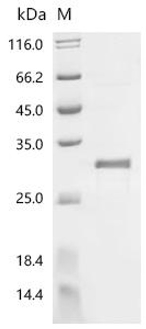 Recombinant Human NADH dehydrogenase [ubiquinone] 1 beta subcomplex subunit 1 (NDUFB1) (CSB-CF015641HU(A4))
