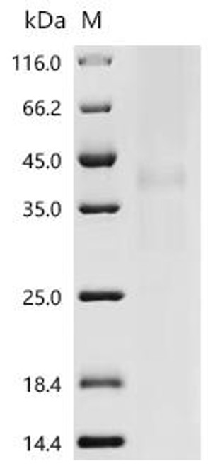 Recombinant Human 5-hydroxytryptamine receptor 4 (HTR4) (CSB-CF622677HU)