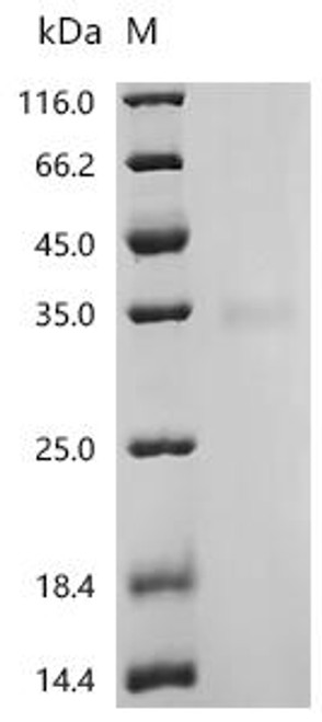 Recombinant Human Trace amine-associated receptor 1 (TAAR1) (CSB-CF847217HU)