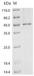 Recombinant Mouse Phosphatidylcholine:ceramide cholinephosphotransferase 1 (Sgms1) (CSB-CF848676MO)