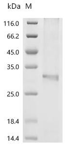 Recombinant Mouse Cholesterol 25-hydroxylase (Ch25h) (CSB-CF005307MO)
