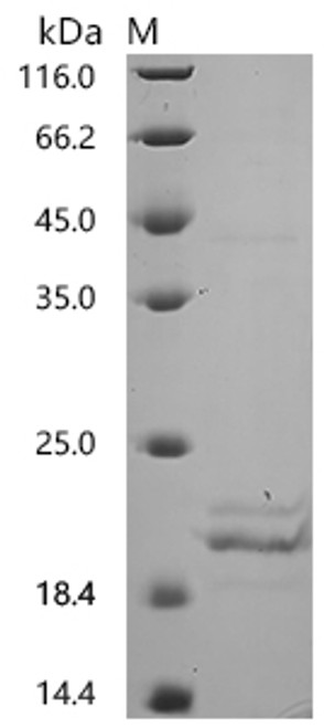Recombinant Human Transthyretin (TTR) (CSB-MP025270HUb1)