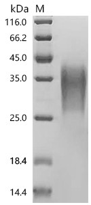 Recombinant Human TGF-beta receptor type-2 (TGFBR2), partial (CSB-MP023452HU2d7)