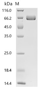 Recombinant Human Ephrin type-A receptor 2 (EPHA2F), partial (Active) (CSB-MP007722HUd7)