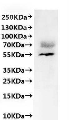 Recombinant Human Metalloreductase STEAP2 (STEAP2)-VLPs (CSB-MP854119HU)