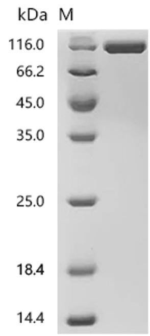 Recombinant Human Roundabout homolog 1 (ROBO1), partial (Active) (CSB-MP896760HU)