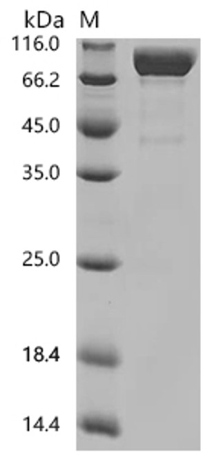 Recombinant Macaca mulatta Interleukin 1 receptor type 1 (IL1R1), partial (CSB-MP6739MOW)