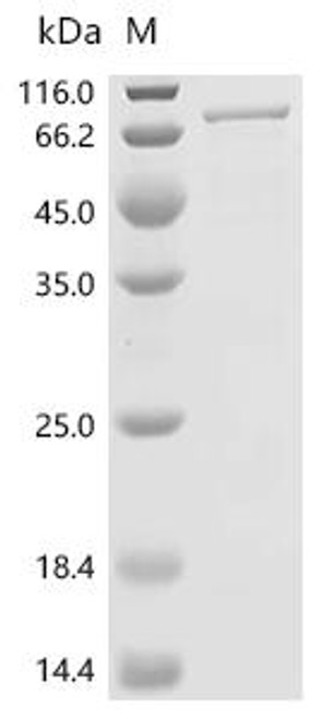 Recombinant Human Alanine--tRNA ligase, mitochondrial (AARS2), partial (CSB-EP711453HU2)