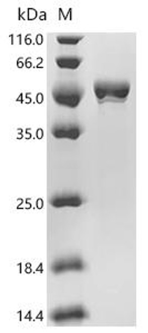 Recombinant Mouse 3-ketoacyl-CoA thiolase A, peroxisomal (Acaa1a) (CSB-EP852843MO)