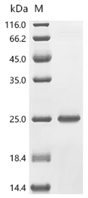Recombinant Mycobacterium tuberculosis Meromycolate extension acyl carrier protein (acpM) (CSB-EP358590MVZa0)