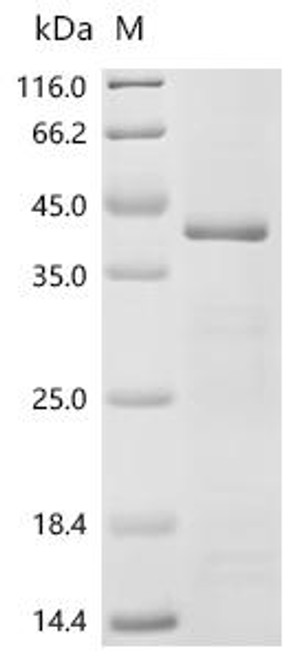 Recombinant Mouse Aryl hydrocarbon receptor (Ahr), partial (CSB-EP001481MO1)