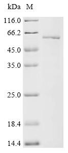 Recombinant Human Aryl hydrocarbon receptor (AHR) , partial (CSB-EP001481HU6)