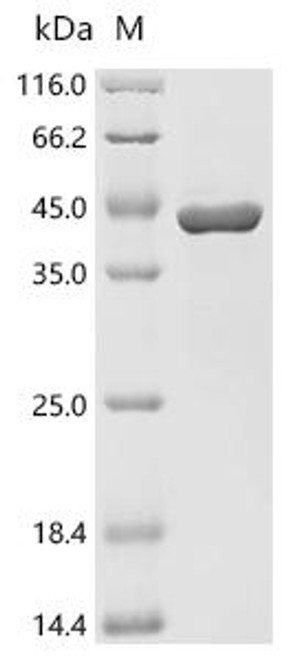 Recombinant Hydra vulgaris Annexin-B12 (ANXB12) (CSB-EP329623HXN)