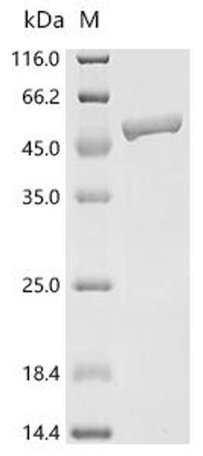 Recombinant Arabidopsis thaliana Serpin-ZX (CSB-EP886615DOA)
