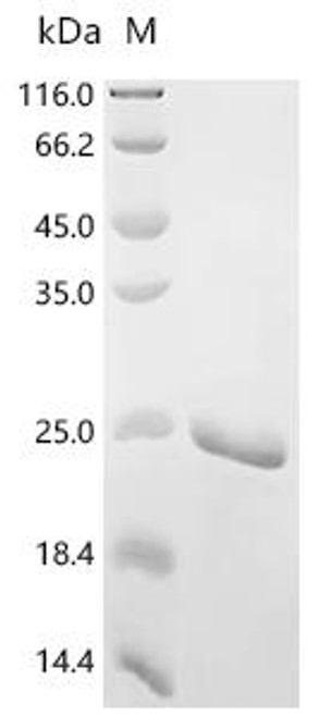 Recombinant Nodamura virus Protein B2 (B2) (CSB-EP881266NED)
