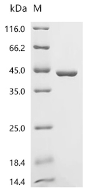 Recombinant Mouse Biliverdin reductase A (Blvra) (CSB-EP002721MO)