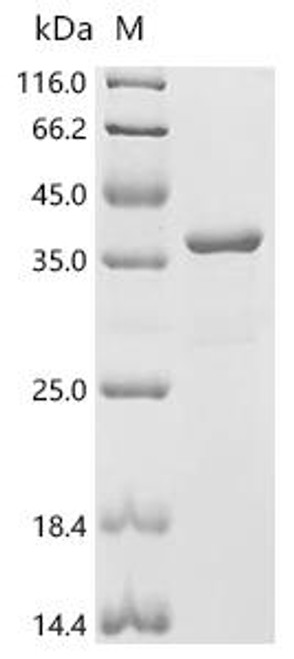 Recombinant Human Tyrosine-protein kinase BTK (BTK) (C481S), partial (CSB-EP002867HU1(M))