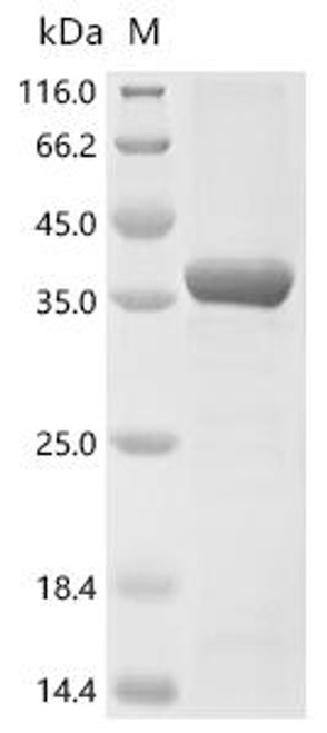 Recombinant Human Tyrosine-protein kinase BTK (BTK) (M437R), partial (CSB-EP002867HU1(M1))