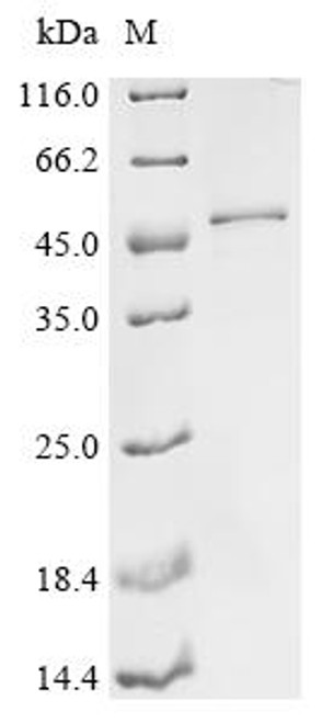 Recombinant Human Complement C1q subcomponent subunit C (C1QC), partial (CSB-EP003641HU1)