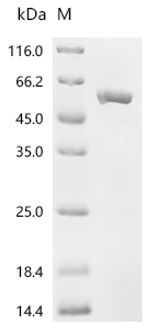 Recombinant Human C-C motif chemokine 17 (CCL17), Biotinylated (CSB-EP856406HU-B)