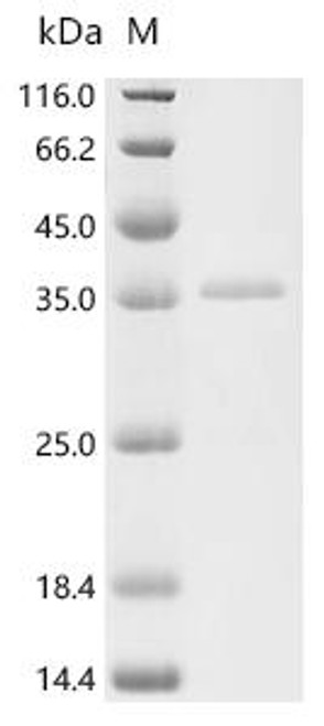 Recombinant Human CMRF35-like molecule 5 (CD300LD), partial, Biotinylated (CSB-EP757797HU1-B)