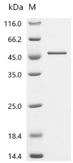 Recombinant Human Chromogranin-A (CHGA), partial (CSB-EP005344HU4d7)