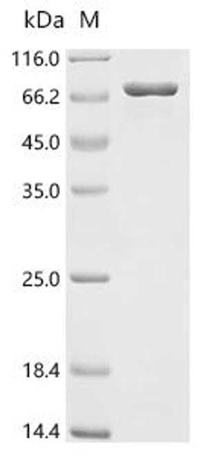 Recombinant Human Neuronal acetylcholine receptor subunit alpha-3 (CHRNA3), partial, Biotinylated (CSB-EP005389HU1-B)