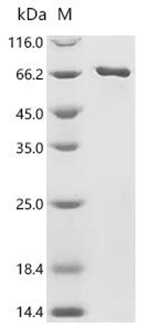 Recombinant Human Neuronal acetylcholine receptor subunit alpha-7 (CHRNA7), partial, Biotinylated (CSB-EP005393HU-B)