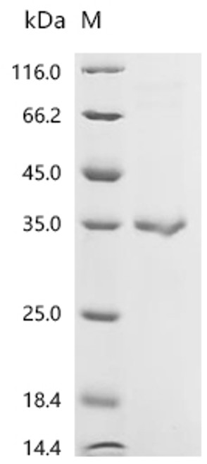 Recombinant Human C-type lectin domain family 4 member G (CLEC4G), partial (CSB-EP744269HU)