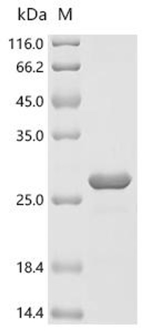 Recombinant Anopheles gambiae AGAP008055-PA (CSP3) (CSB-EP6895BZL)