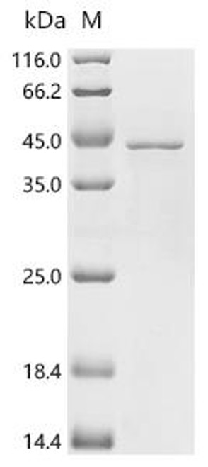 Recombinant Mouse NADH-cytochrome b5 reductase 3 (Cyb5r3) (CSB-EP887597MO)