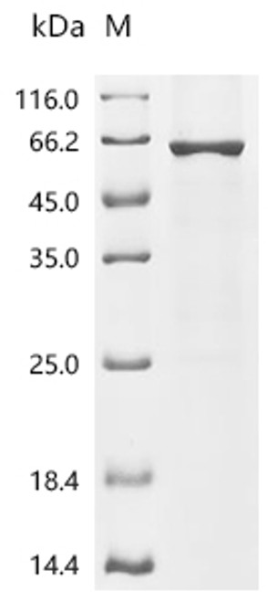 Recombinant Human Cytochrome P450 11B1, mitochondrial (CYP11B1) (CSB-EP006390HUd7)