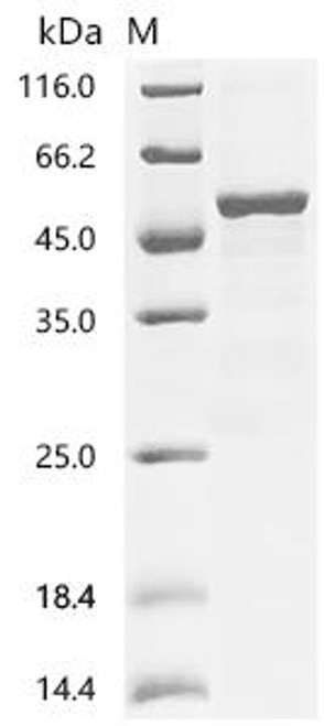 Recombinant Human Dihydroorotate dehydrogenase (quinone), mitochondrial (DHODH), partial (CSB-EP006852HU1d7)