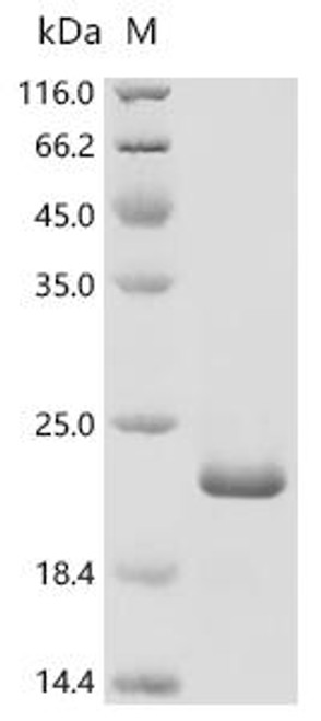 Recombinant Human papillomavirus type 34 Protein E7 (E7) (CSB-EP330647HNG)
