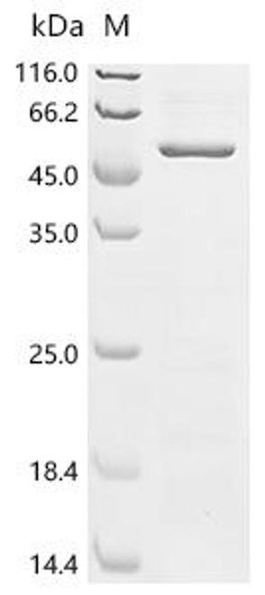 Recombinant Human Egl nine homolog 1 (EGLN1) (CSB-EP863932HU(A4))