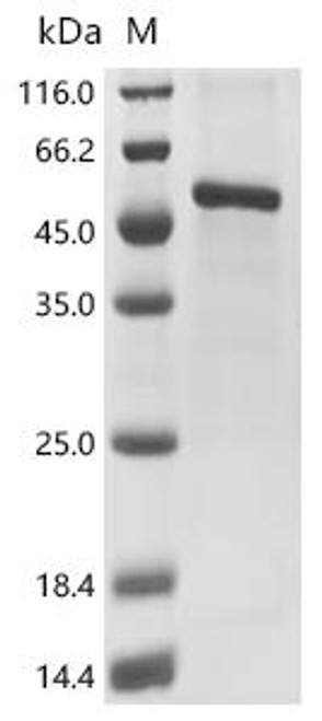 Recombinant Moloney murine leukemia virus Envelope glycoprotein (env), partial (CSB-EP361038MHK)