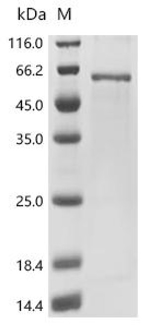 Recombinant Baboon endogenous virus Envelope glycoprotein (env), partial (CSB-EP320630BAB)