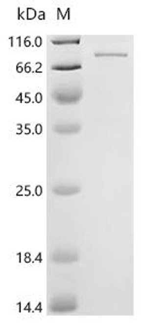 Recombinant Human Eosinophil peroxidase (EPX) (CSB-EP007756HUc7)